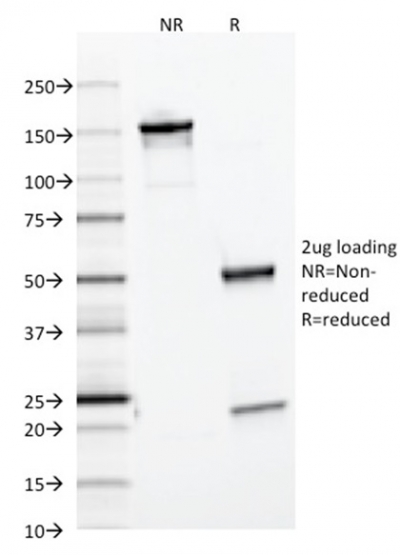 Data from SDS-PAGE analysis of Anti-Ferritin Light Chain antibody (Clone FTL/1386). Reducing lane (R) shows heavy and light chain fragments. NR lane shows intact antibody with expected MW of approximately 150 kDa. The data are consistent with a high purity, intact mAb.